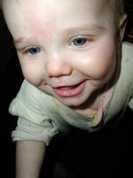 Baby Teeth